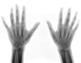 Multato un fornitore di housing sociale per aver ignorato il rischio di lesioni da vibrazione degli utensili elettrici 
Multato un fornitore di housing sociale per aver ignorato il rischio di lesioni da vibrazione degli utensili elettrici
Un fornitore di housing sociale delle Midlands Orientali è stato multato di 32.000 sterline dopo che numerosi lavoratori sono stati diagnosticati con lesioni correlate alle vibrazioni.
Approfondimento
L'incidente mette in evidenza l'importanza di prendere misure adeguate per prevenire lesioni correlate alle vibrazioni negli ambienti di lavoro, in particolare quando si utilizzano utensili elettrici.
Possibili Conseguenze
Le lesioni correlate alle vibrazioni possono avere gravi conseguenze per la salute e la sicurezza dei lavoratori, e possono anche avere un impatto significativo sulle aziende in termini di costi e produttività.
Opinione
È fondamentale che le aziende prendano seriamente il rischio di lesioni correlate alle vibrazioni e adottino misure efficaci per prevenirle, al fine di proteggere la salute e la sicurezza dei loro lavoratori.
Analisi Critica dei Fatti
L'incidente sottolinea la necessità di una gestione efficace dei rischi negli ambienti di lavoro, e di una maggiore consapevolezza dei pericoli associati all'utilizzo di utensili elettrici.
Relazioni con altri fatti
Questo incidente è parte di un problema più ampio relativo alla sicurezza e salute nei luoghi di lavoro, e sottolinea l'importanza di una regolamentazione e di un controllo efficaci per prevenire lesioni e malattie occupazionali.
Contesto storico
La questione della sicurezza e salute nei luoghi di lavoro è stata oggetto di dibattito e di interventi normativi per molti anni, e questo incidente ne è un esempio concreto.
Fonti
La fonte di questo articolo è The Construction Index. Per ulteriori informazioni, si prega di visitare il sito web della fonte.